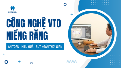 Công nghệ VTO niềng răng - Tối ưu thời gian điều trị và chi phí